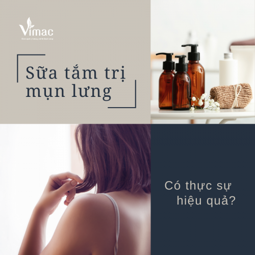 Sữa tắm trị mụn lưng liệu có thực sự hiệu quả? 