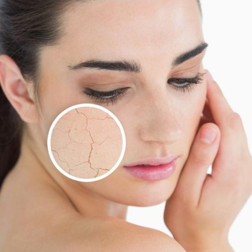 EFFECTIVE HOME ROUTINE FOR MOISTURIZED, TIGHTENED, AND GLOSSY DRY SKIN