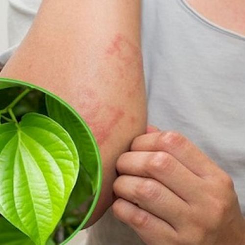 5 phương pháp trị viêm nang lông hiệu quả ngay tại nhà