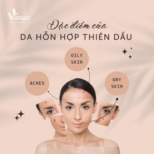 Đặc điểm của da hỗn hợp thiên dầu và cách chọn toner cho da hỗn hợp thiên dầu