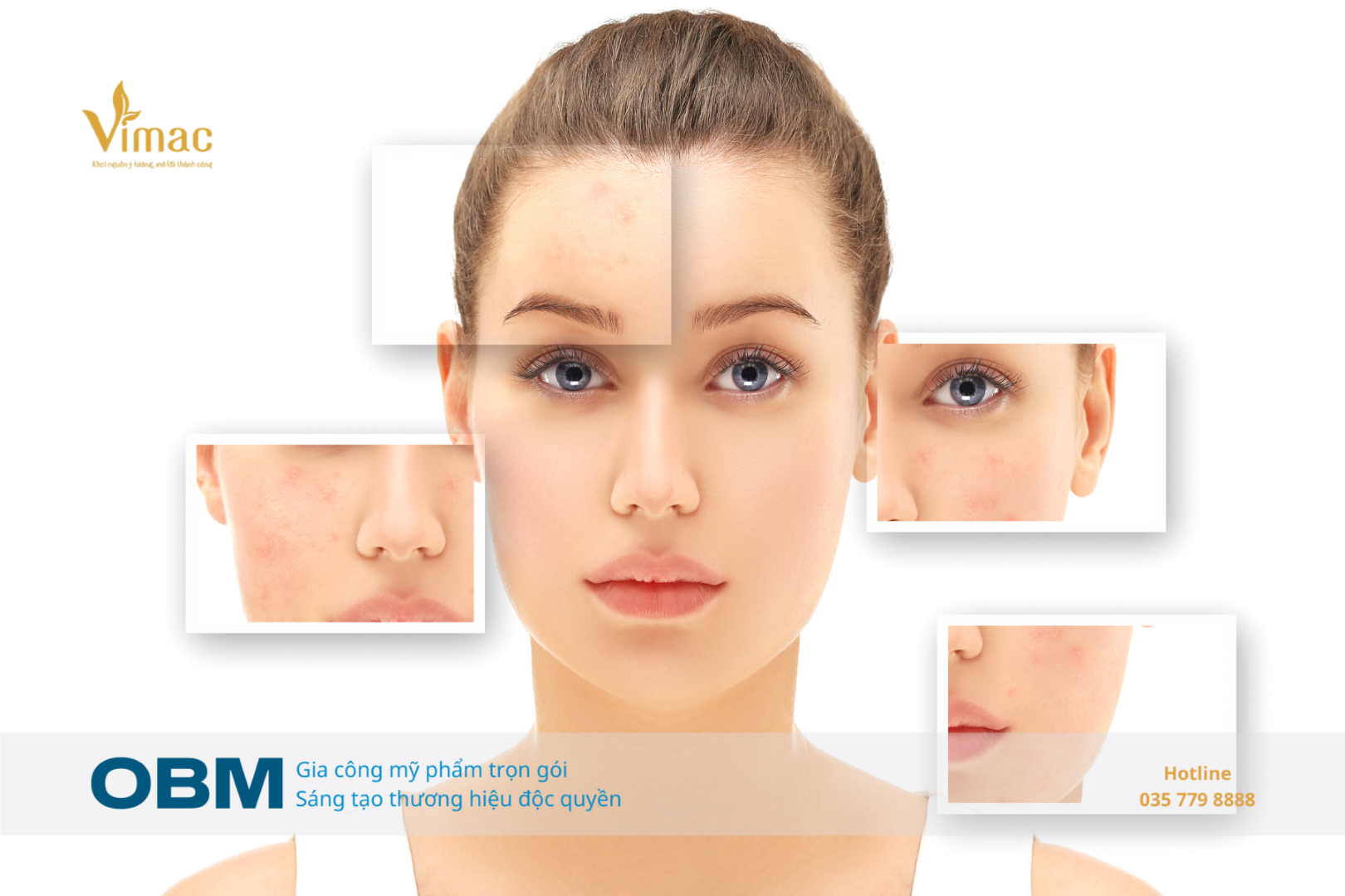 gia công kem trị thâm